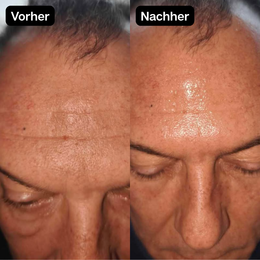 Vorher Nachher 2