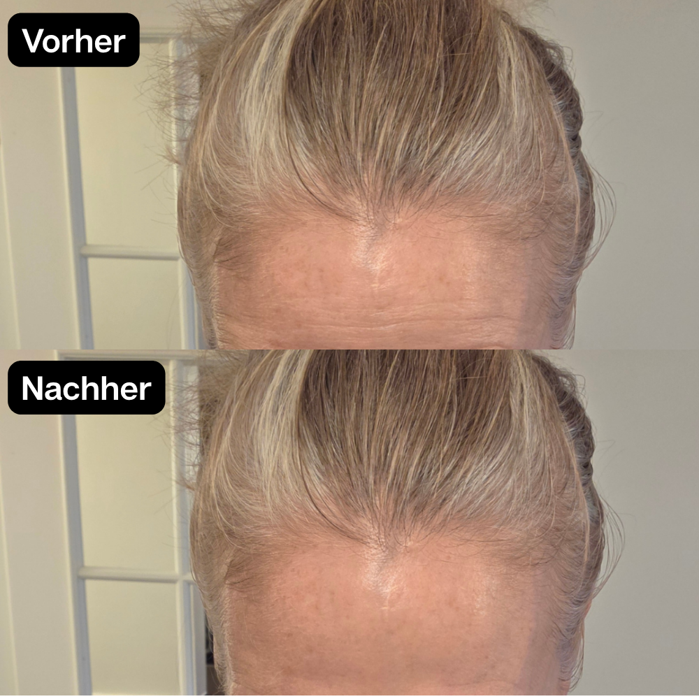 Vorher Nachher 3