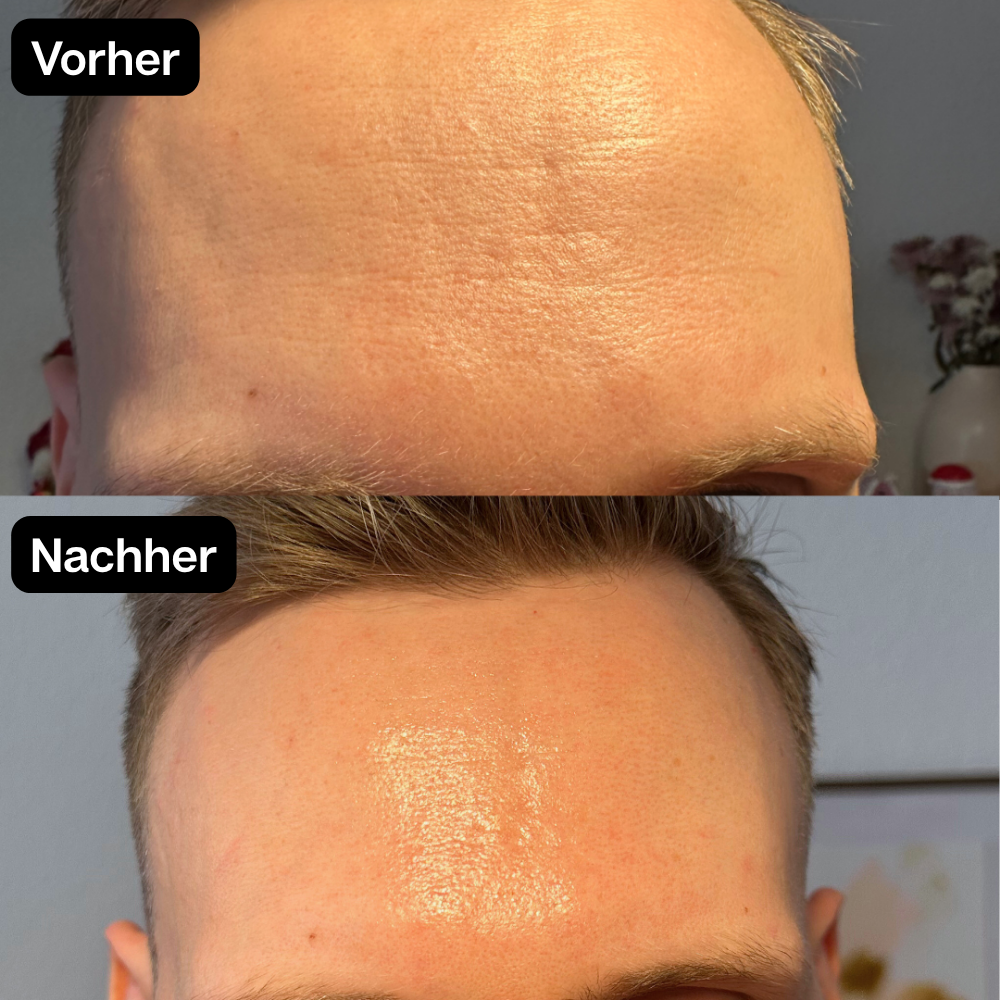 Vorher Nachher 4