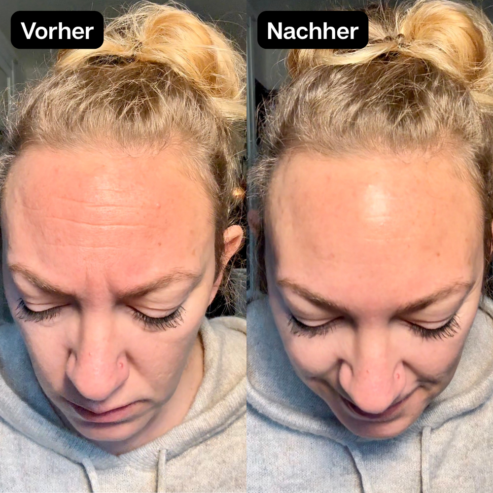 Vorher Nachher 5