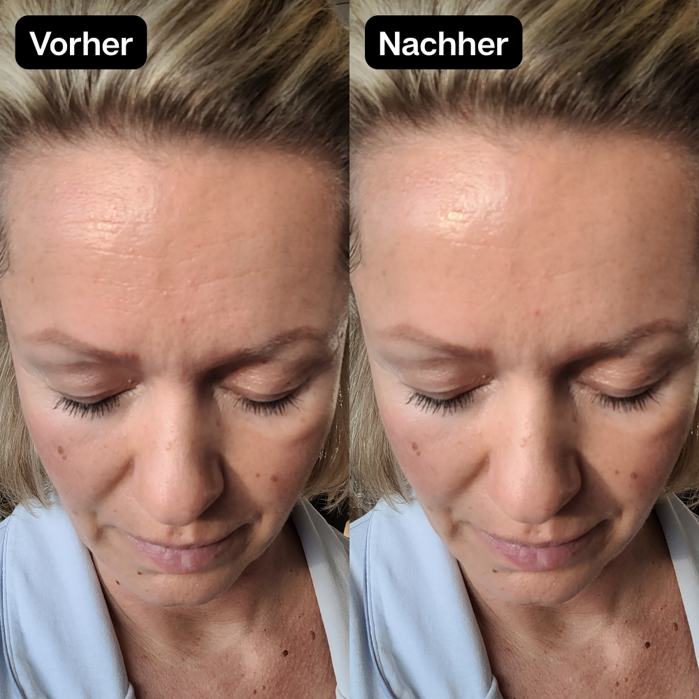 Vorher Nachher 6