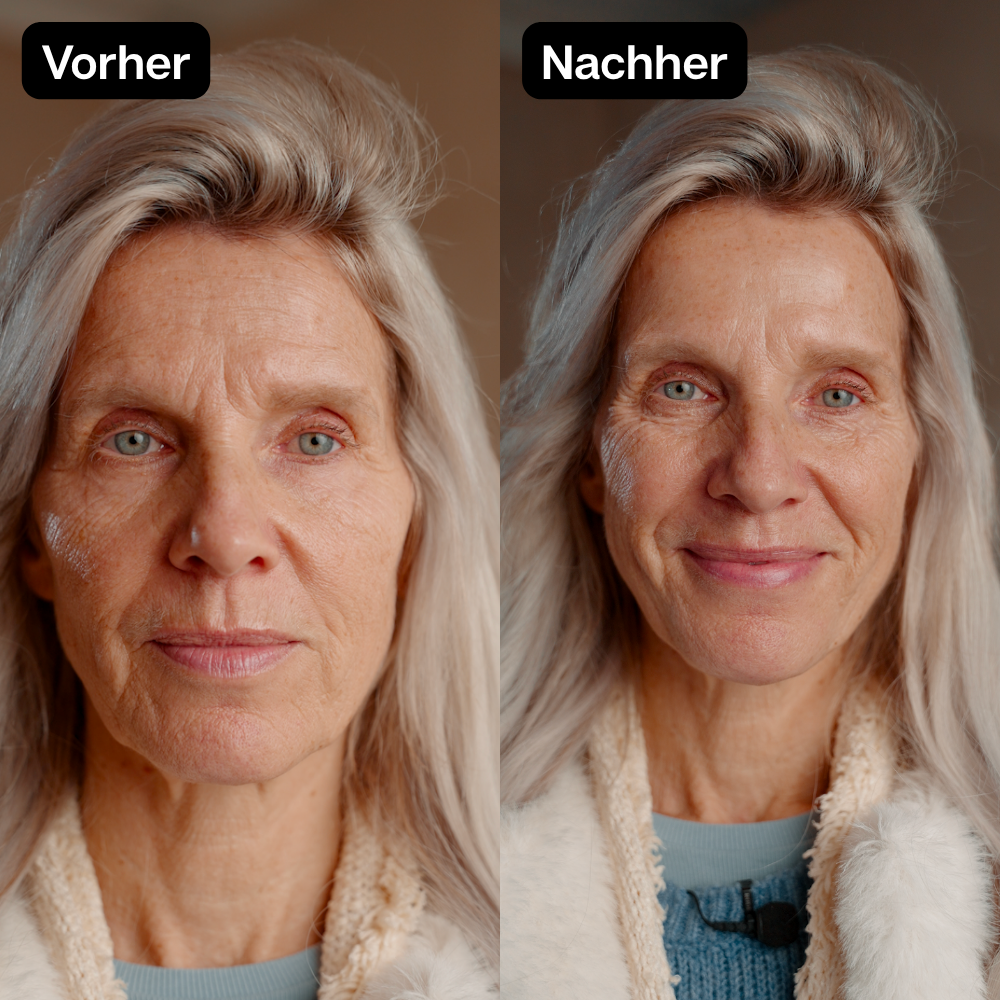 Vorher Nachher 7
