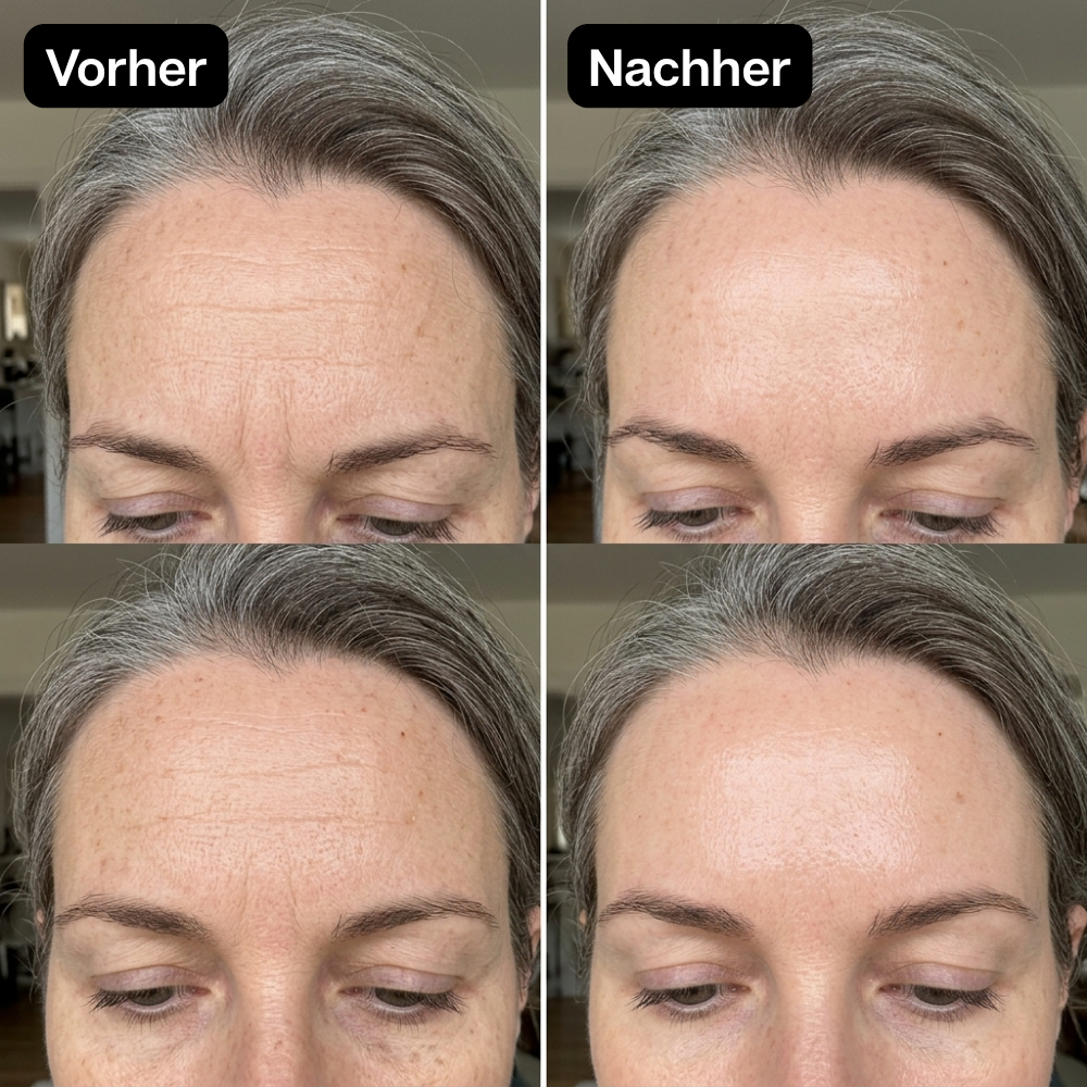 Vorher Nachher 9